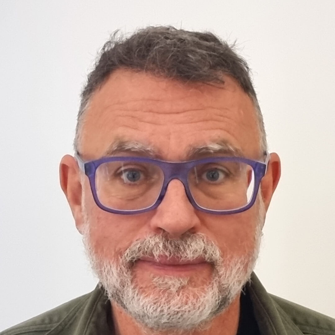 Hajbeültetés előtte-utána: Villám Géza - HIMG hajbeültetési klinika